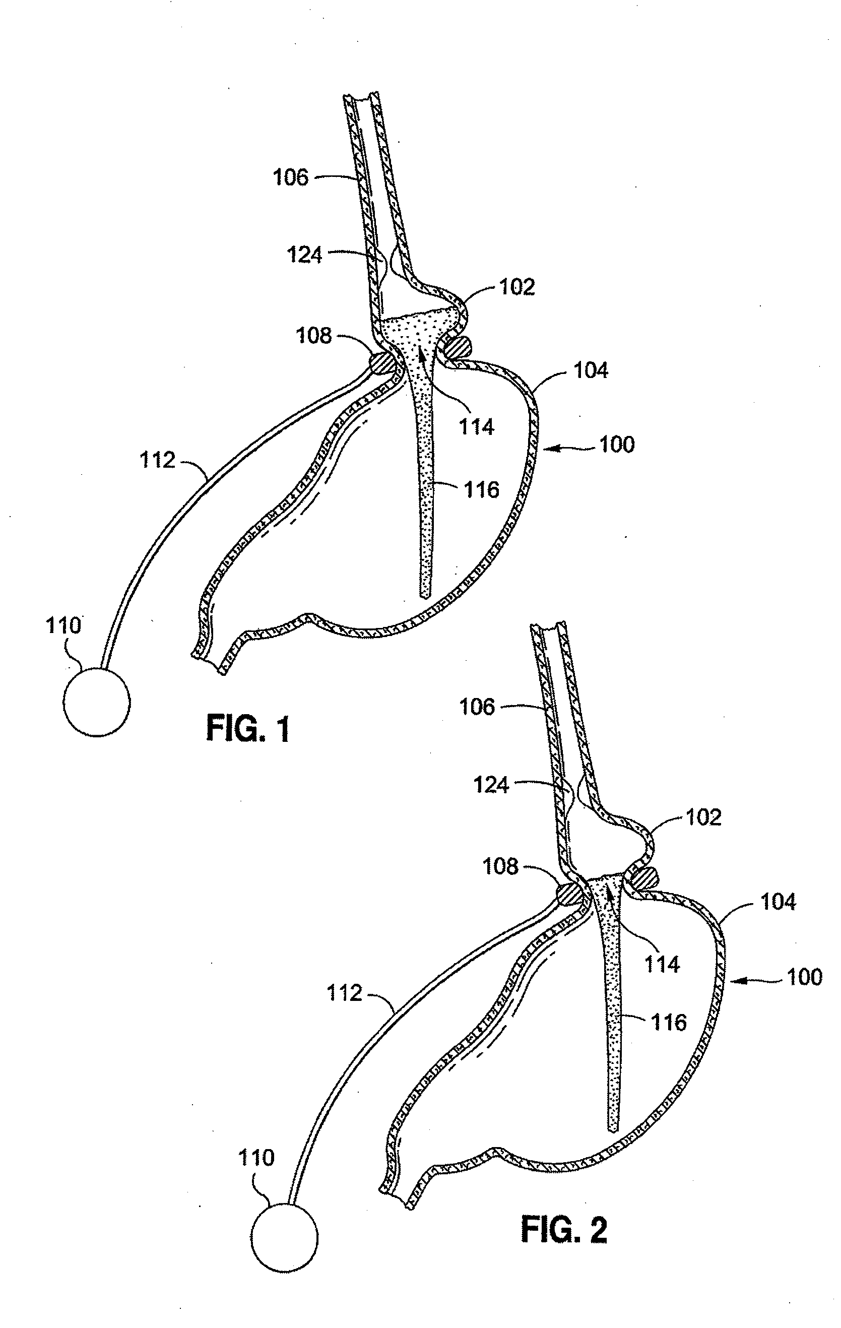 External sensing systems and methods for gastric restriction devices