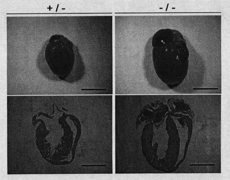 Establishment of cytoskeleton binding protein WDR1 gene knockout model and application of model