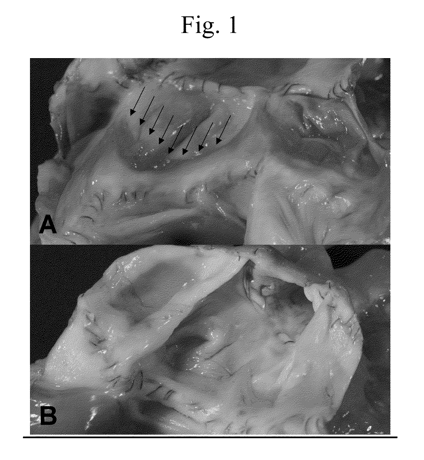 Method for ice-free cryopreservation of tissue