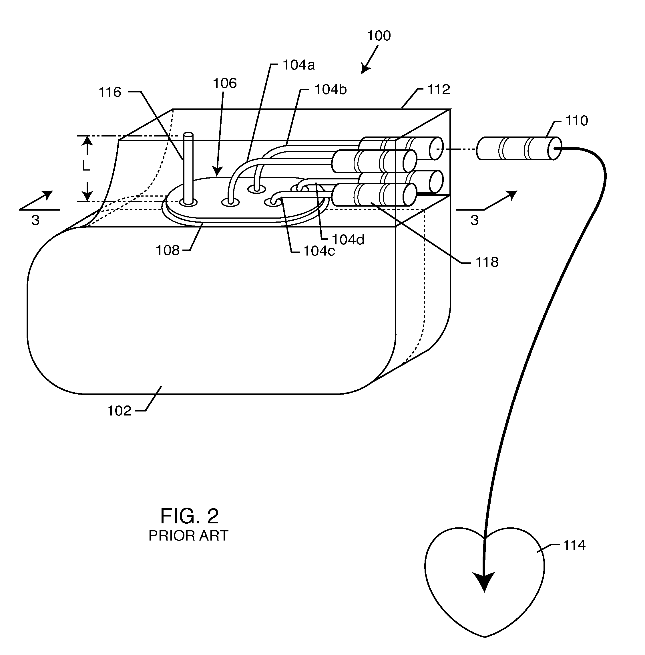 Band stop filter employing a capacitor and an inductor tank circuit to enhance MRI compatibility of active implantable medical devices