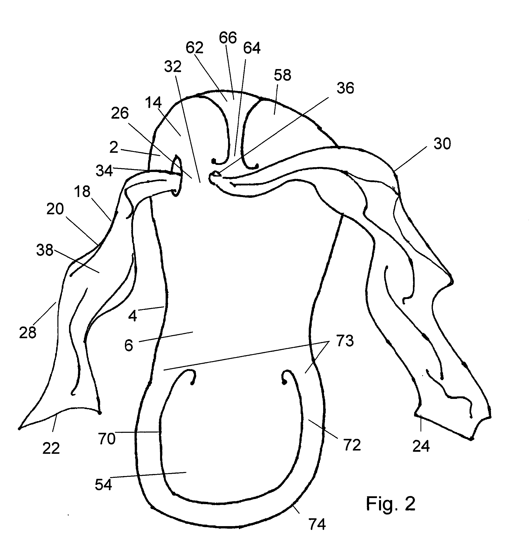 Pedicure Slipper with Toe Separator and Method