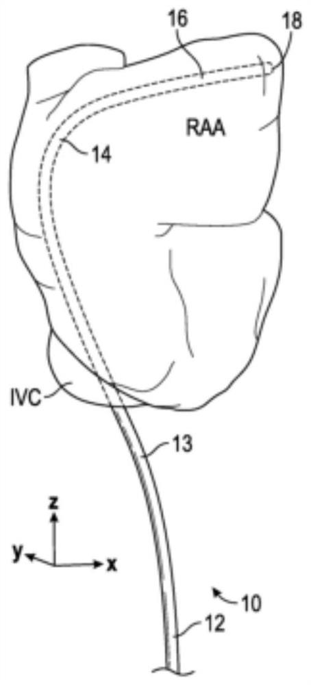 Three-dimensional Right Atrial Appendage Curved Catheter