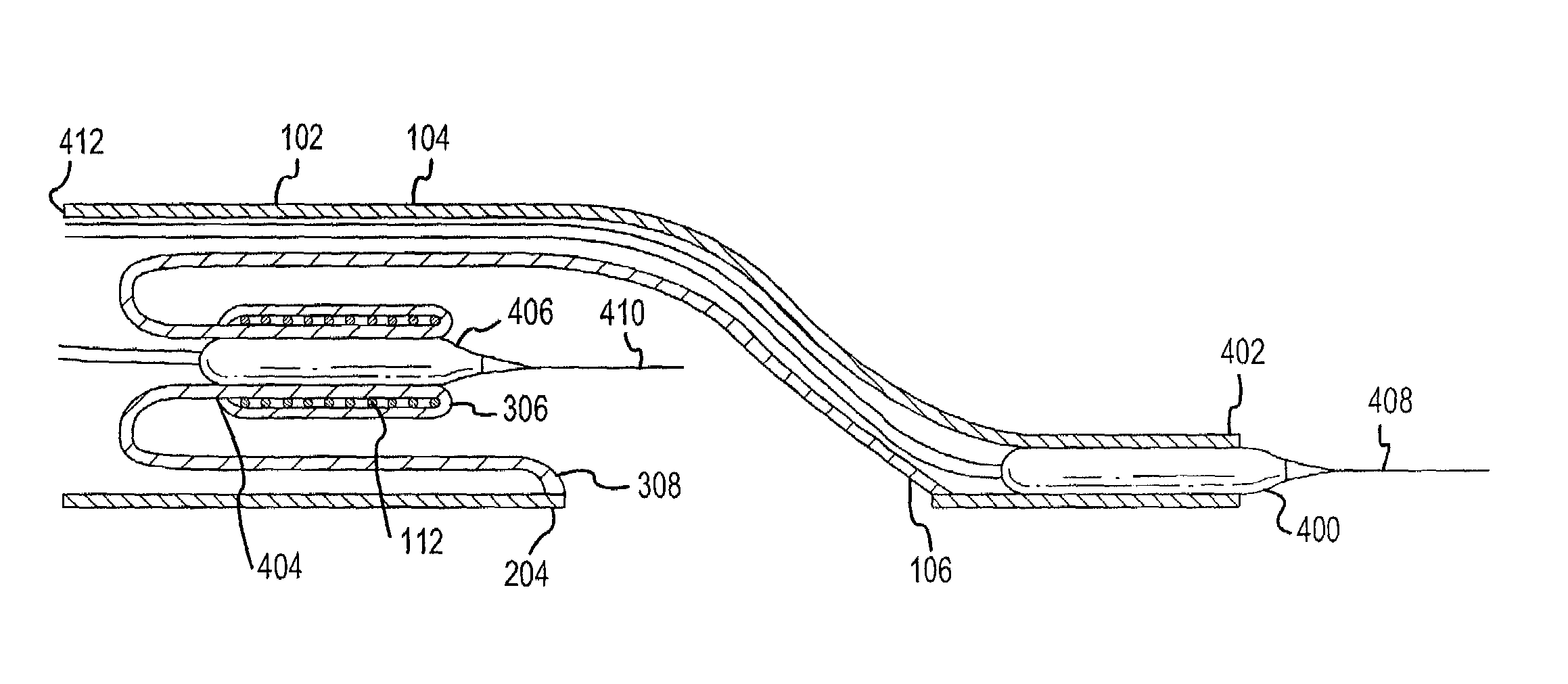 Apparatus and methods for conduits and materials