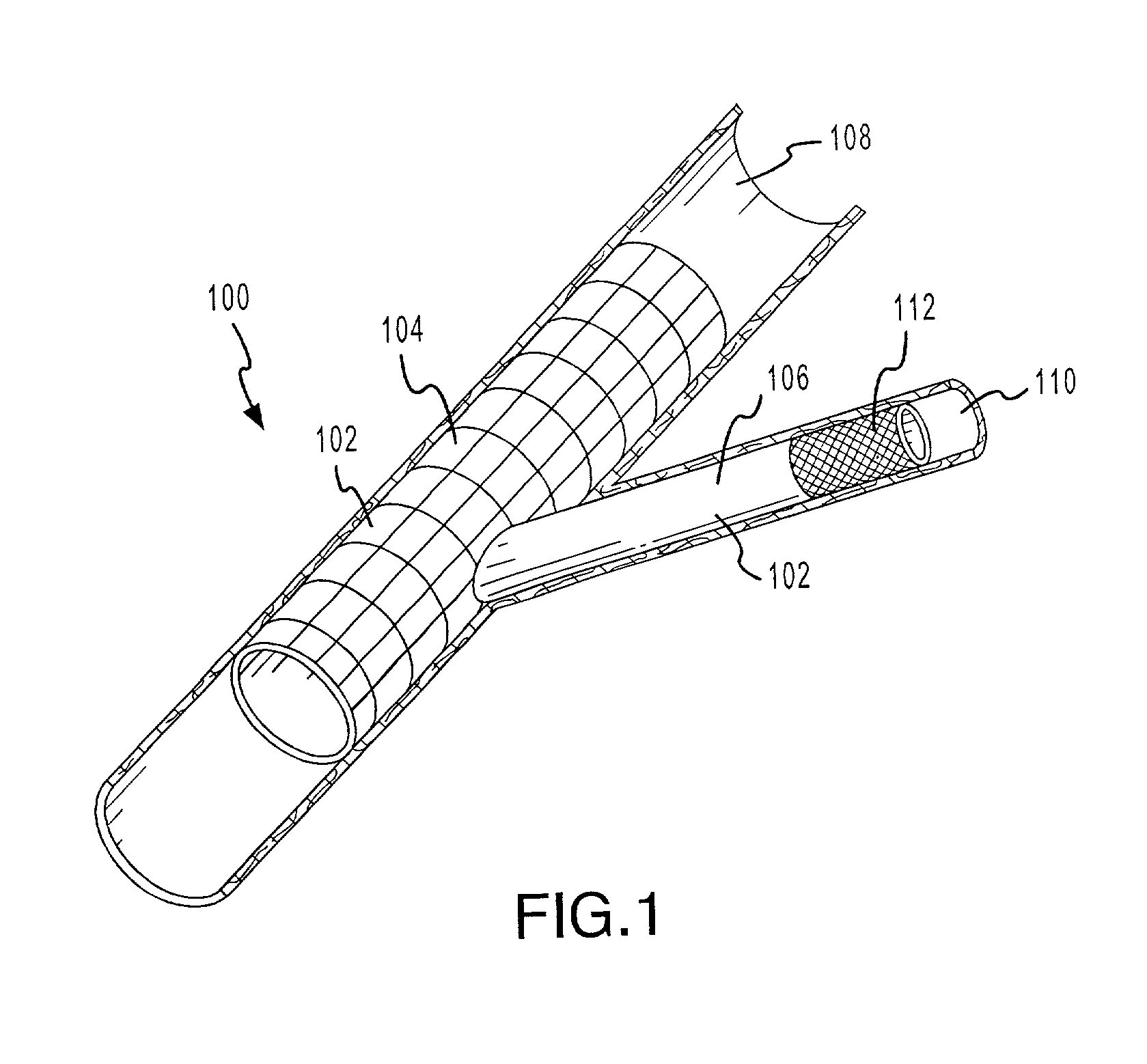 Apparatus and methods for conduits and materials