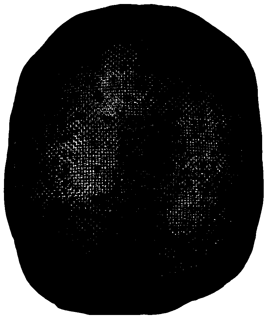 Carbon fiber composite skull repairing patch and preparation method thereof