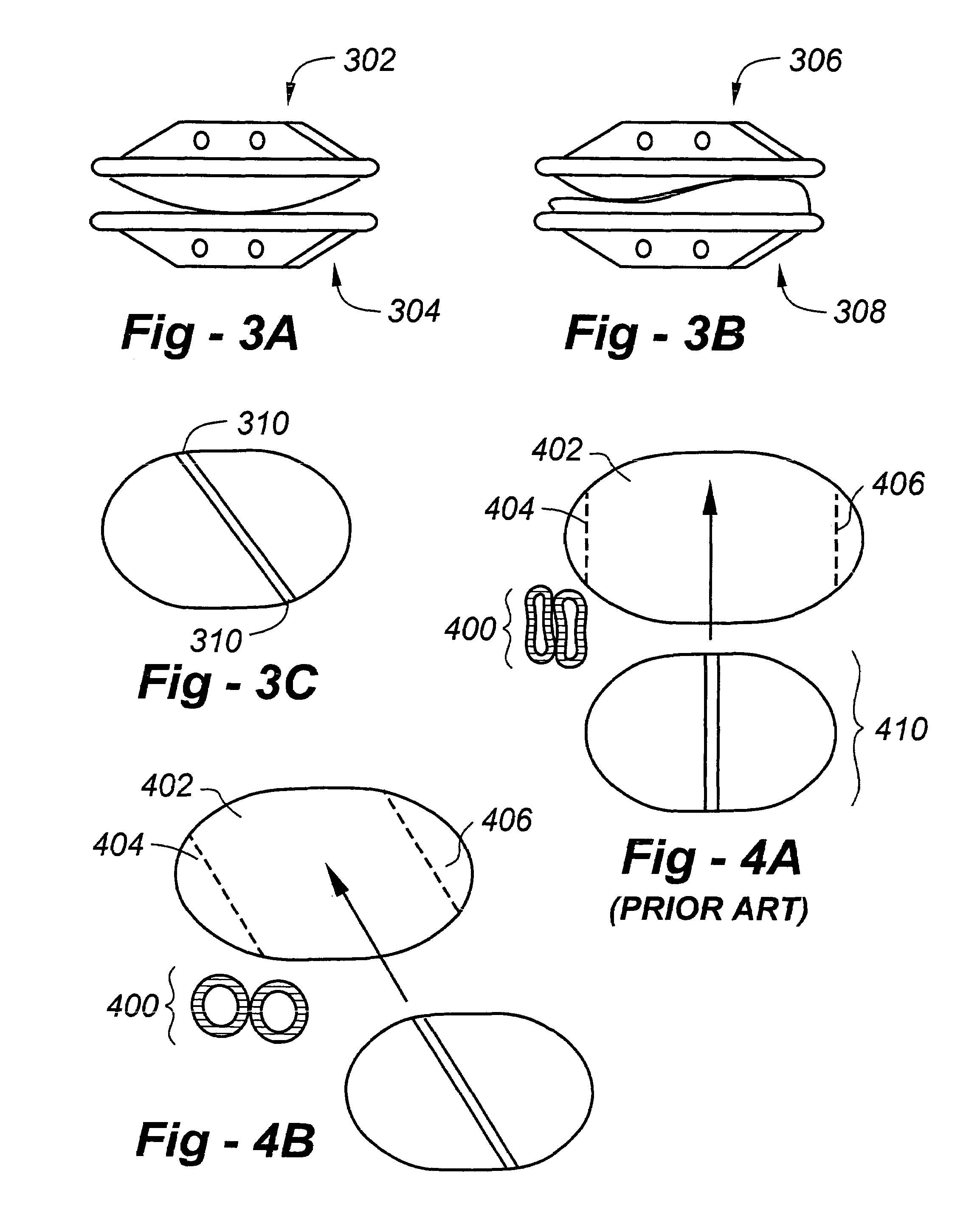 Methods and apparatus for total disc replacements with oblique keels