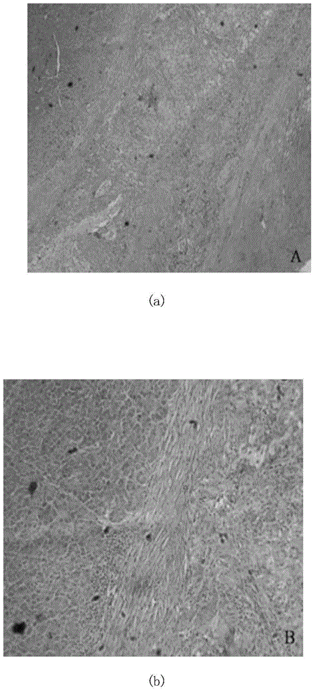 Medical organosilicone material for pancreas and intestine anastomosis instrument and preparation method thereof