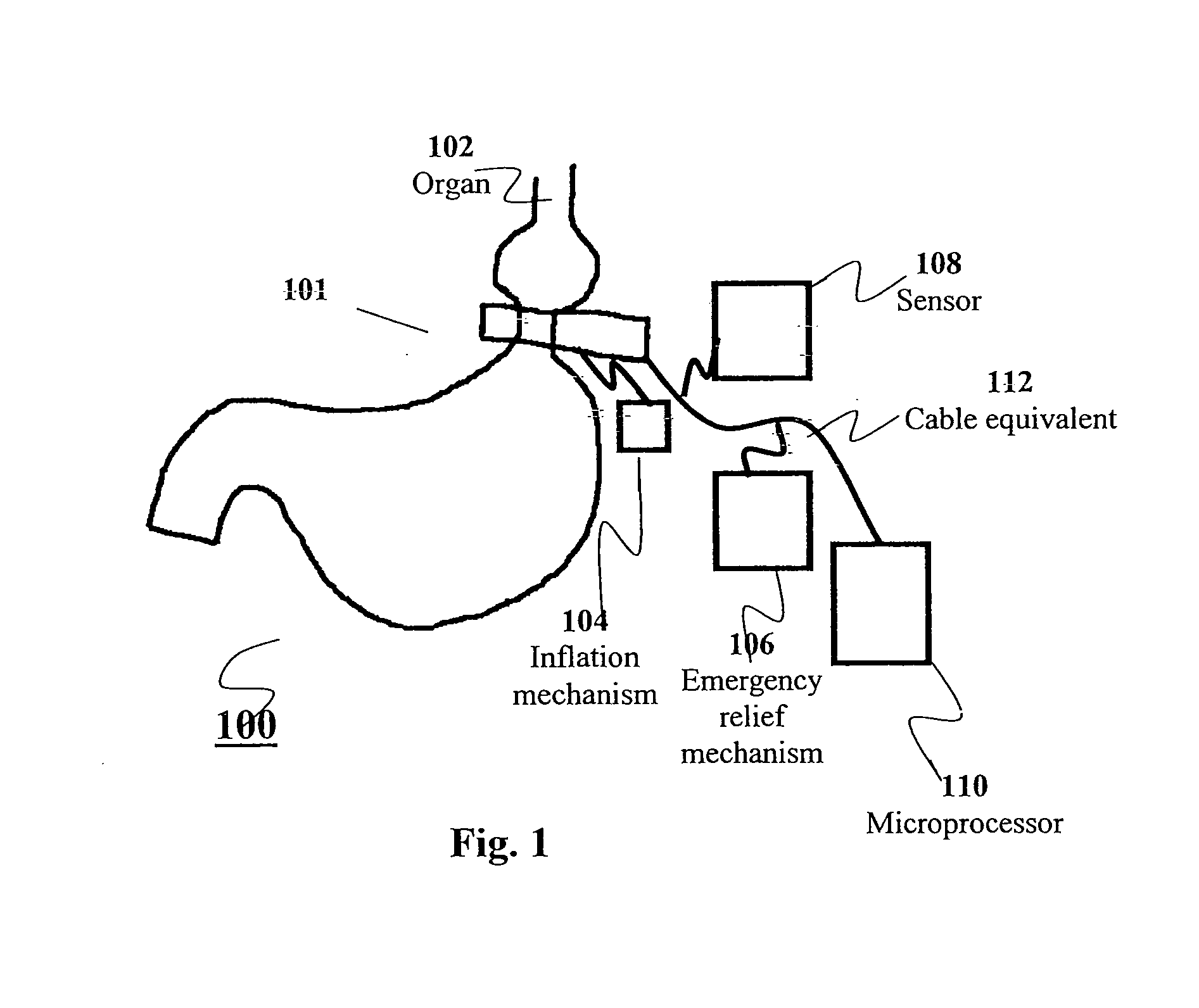 Apparatus and methods for corrective guidance of eating behavior after weight loss surgery