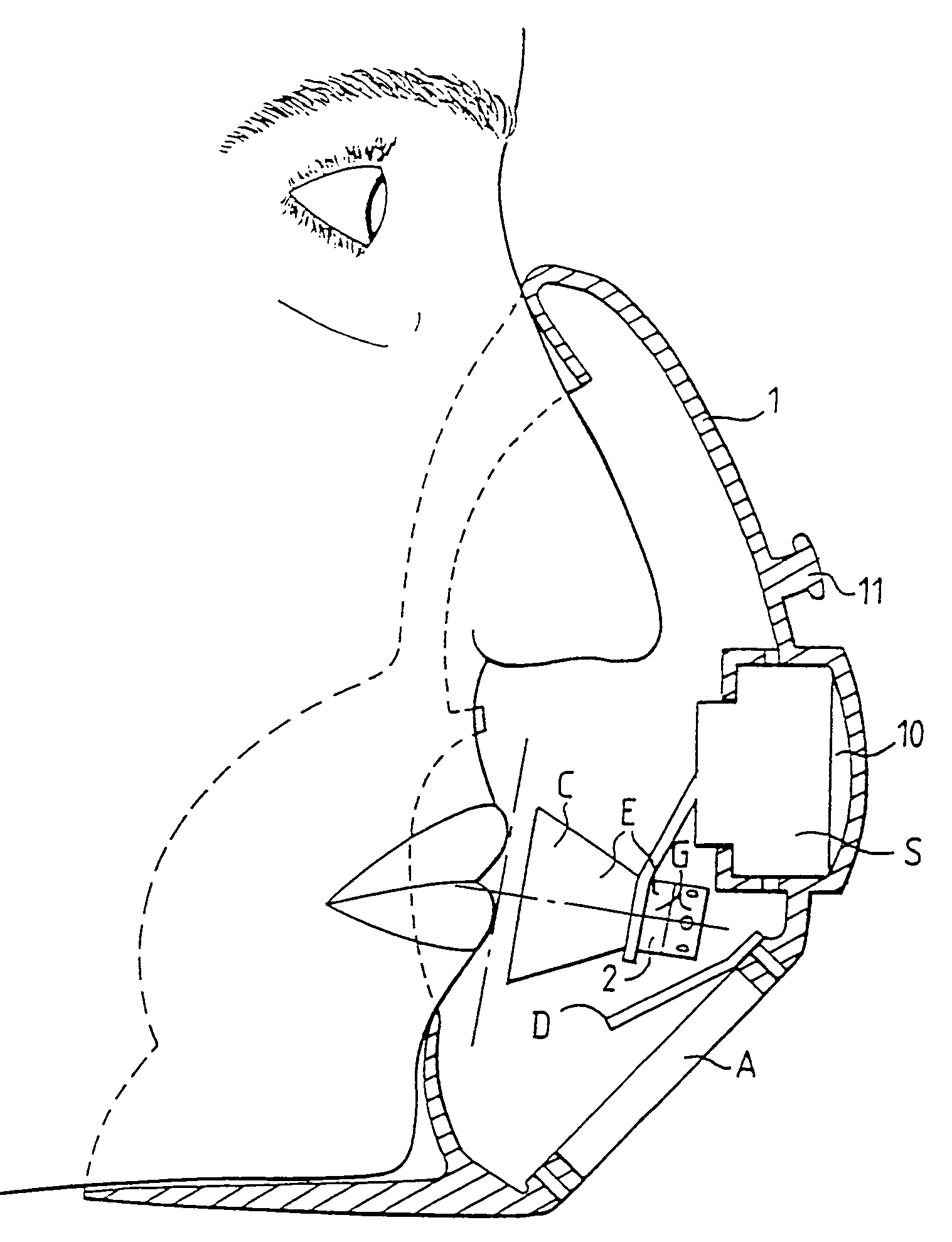 Oxygen inhaler mask with sound pickup device