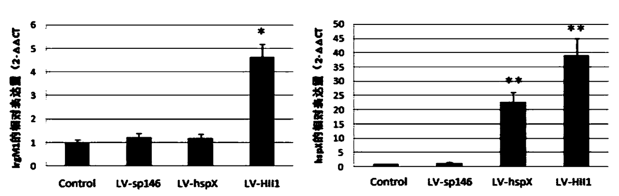 Tuberculosis vaccine and preparation technology thereof