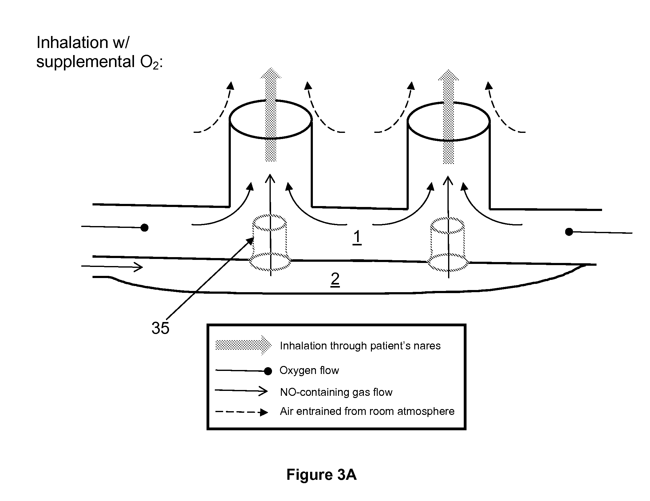 Method of delivering medical gases via a nasal cannula assembly with flow control passage communicating with a deformable reservoir