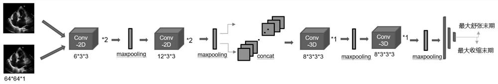 Ultrasonic cardiogram contraction/relaxation end-stage frame automatic identification method based on deep learning