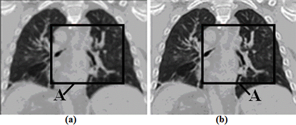 Super-resolution reconstruction method of lung 4D-CT images based on registration