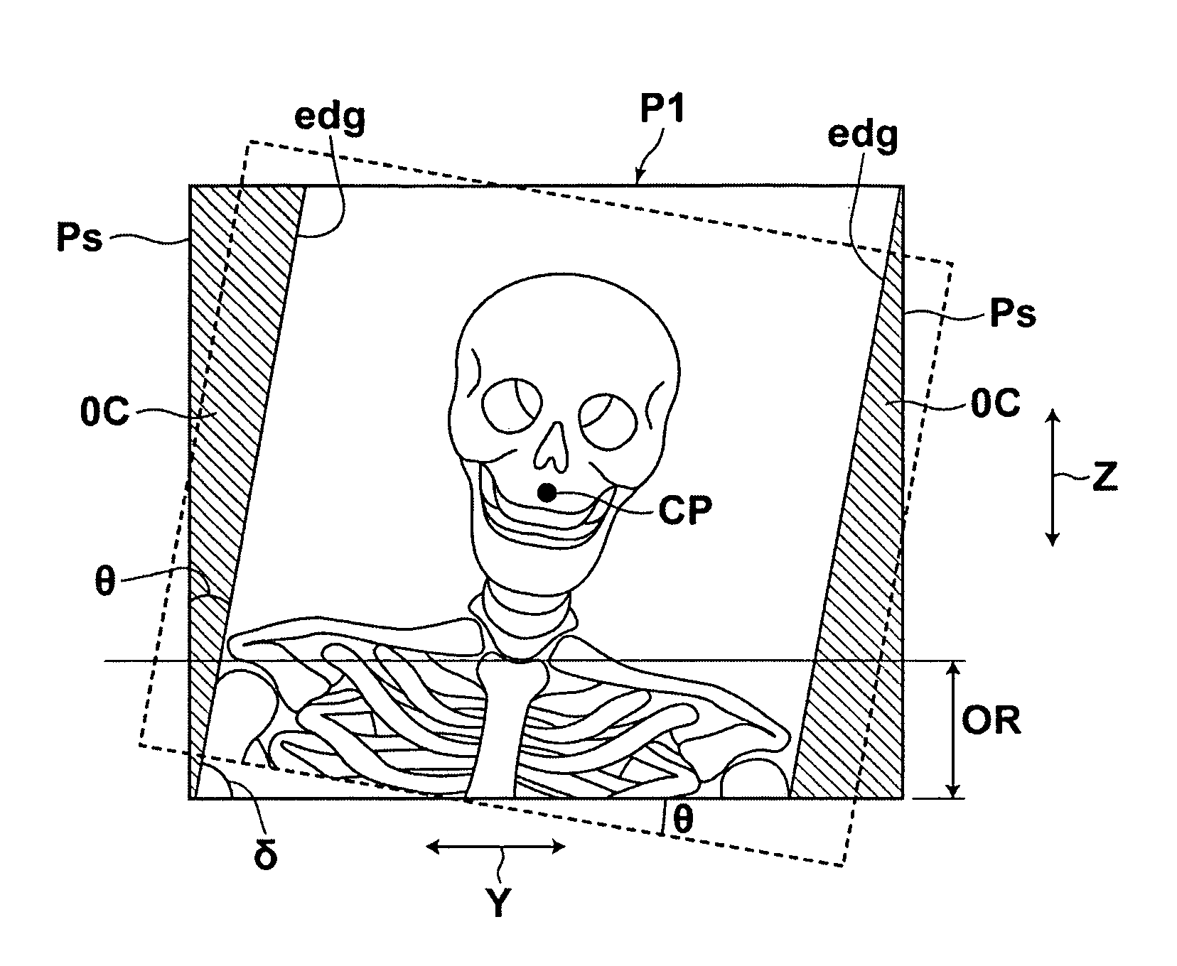 Radiographic image detection apparatus
