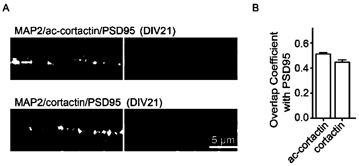 A kind of cortical actin mutant 8KQ and its application