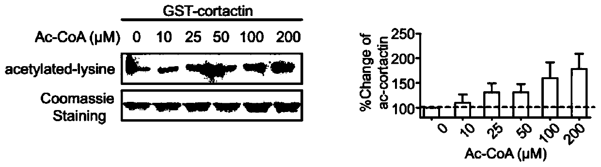 A kind of cortical actin mutant 8KQ and its application