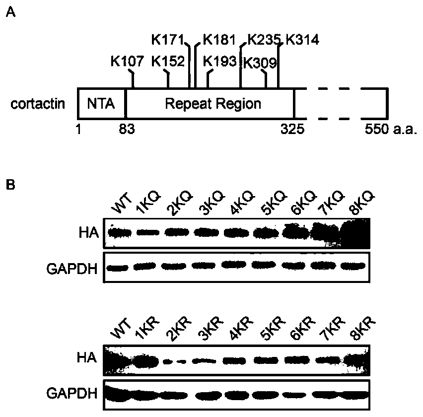 A kind of cortical actin mutant 8KQ and its application