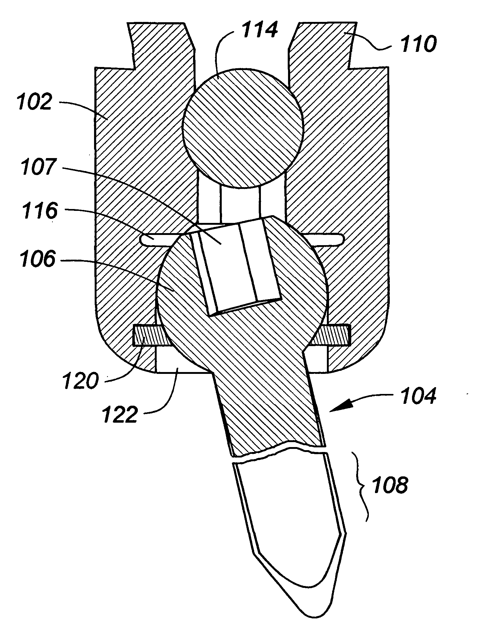 Spinal correction system with multi-stage locking mechanism