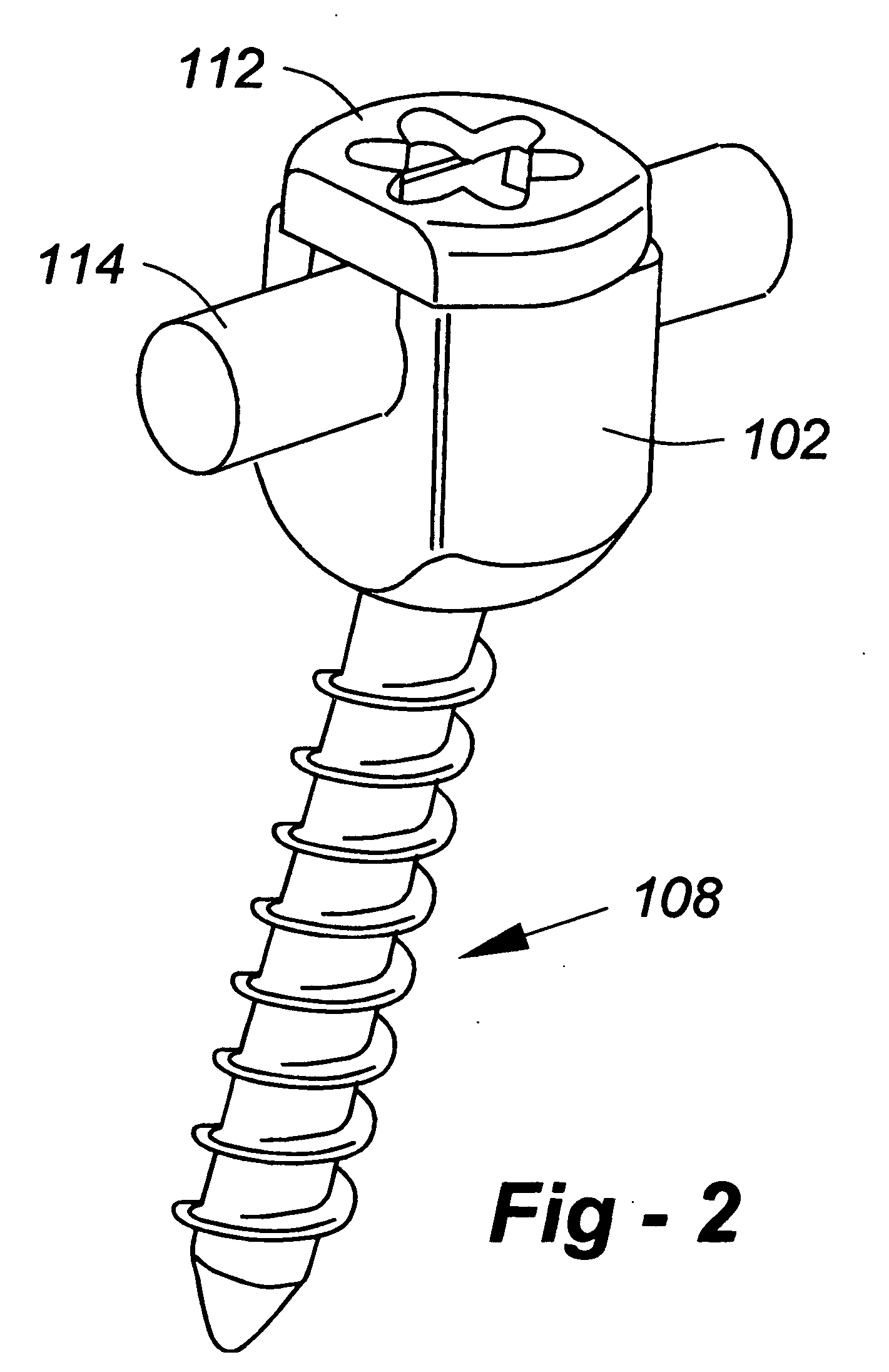 Spinal correction system with multi-stage locking mechanism