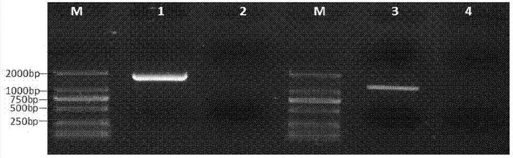 Recombinant expression plasmid and application thereof in preparing anti-tumor immunogene therapeutic medicament