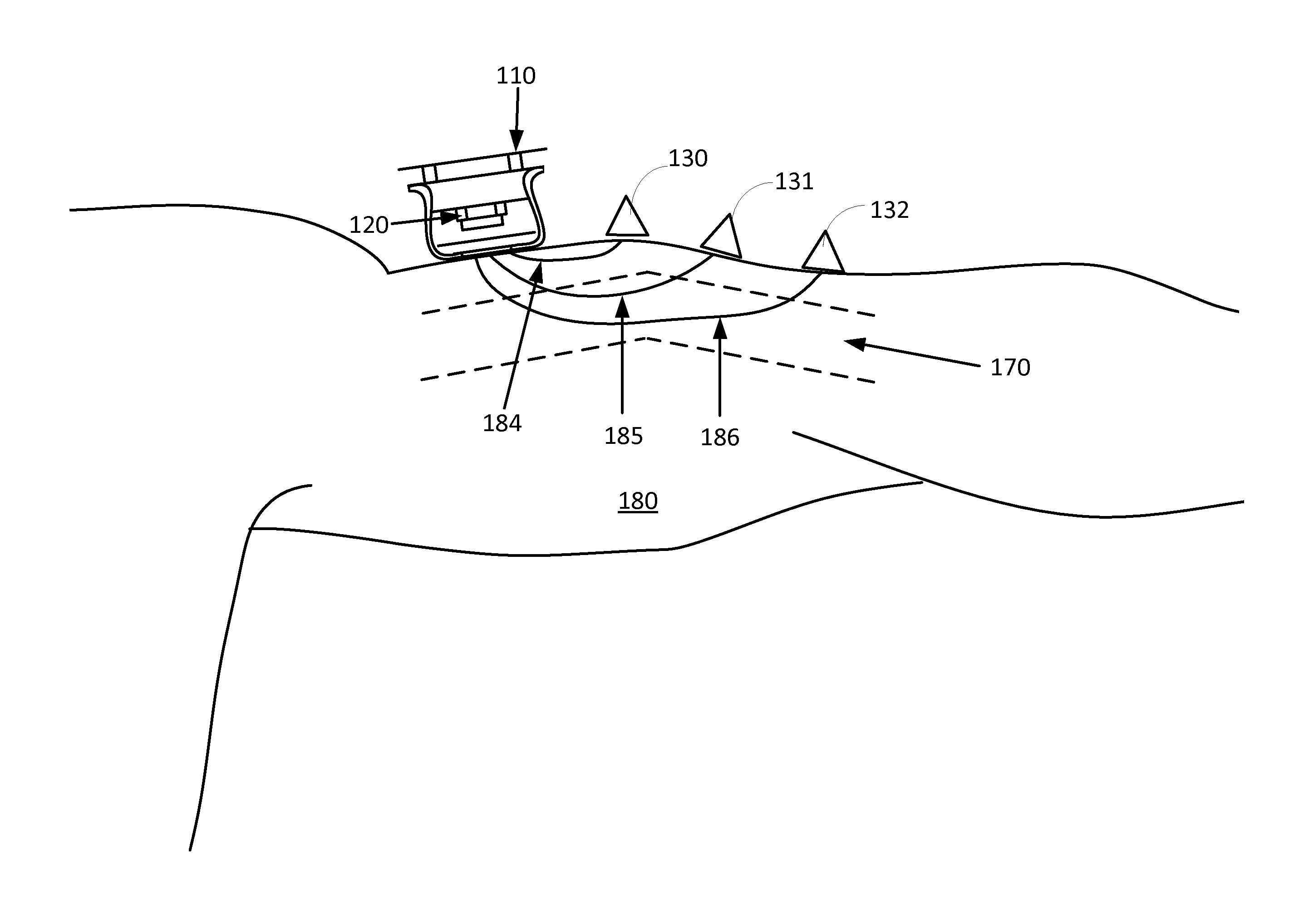 Method and apparatus for selecting wavelengths for optical measurements of a property of a molecular analyte