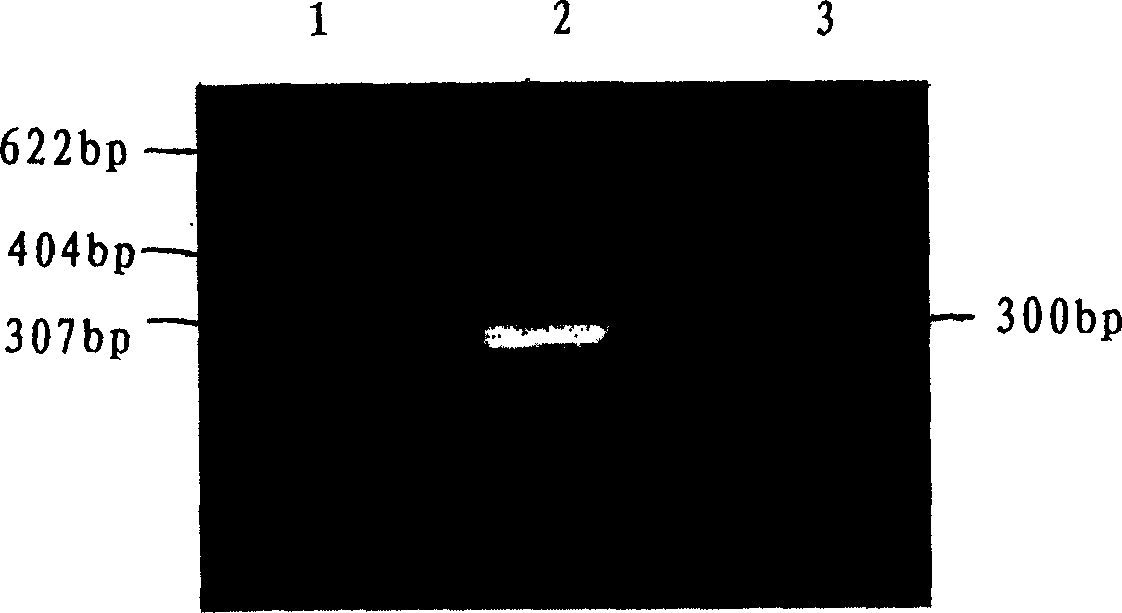 Recombinant virus containing BPI gene and pharmaceutical composition containing same and uses