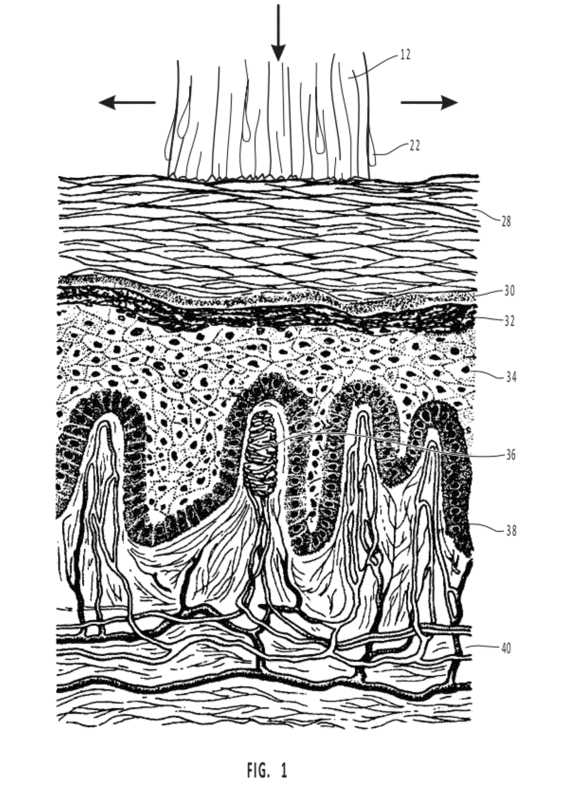 Highly penetrating compositions and methods for treating pathogen-induced disordered tissues