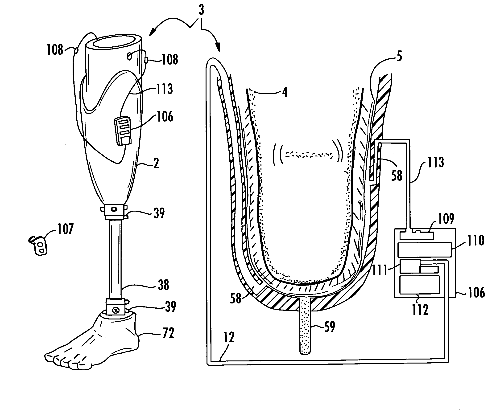Vacuum assisted heat/perspiration removal system and limb volume management for prosthetic device