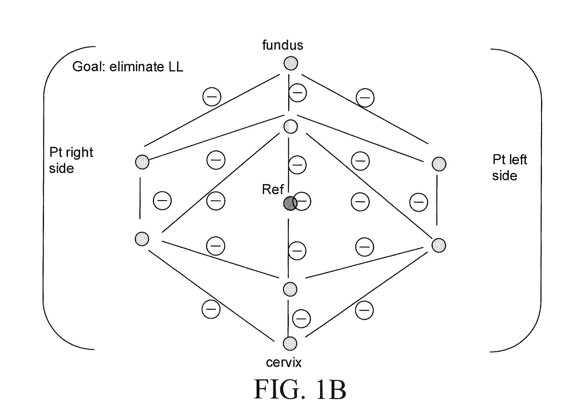 System and Method for Analyzing Progress of Labor and Preterm Labor