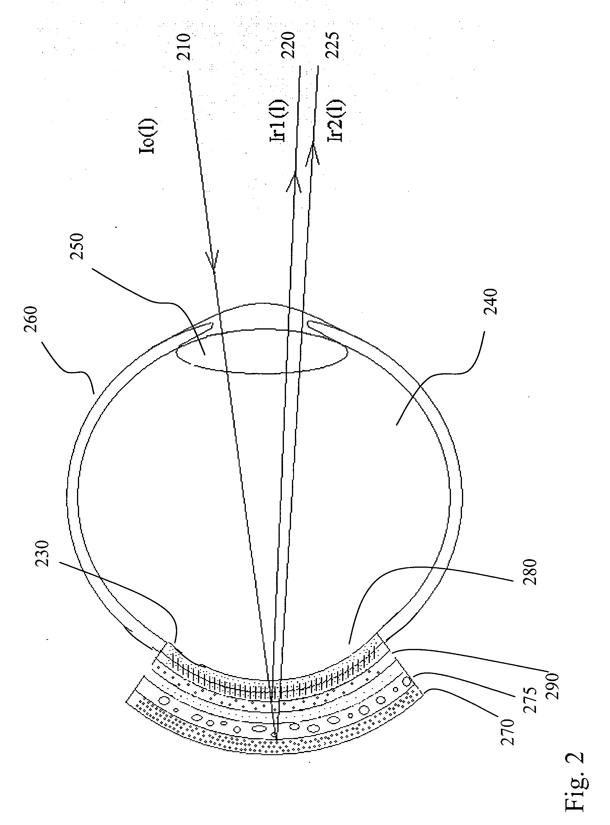 Method and apparatus for correlated ophthalmic measurements