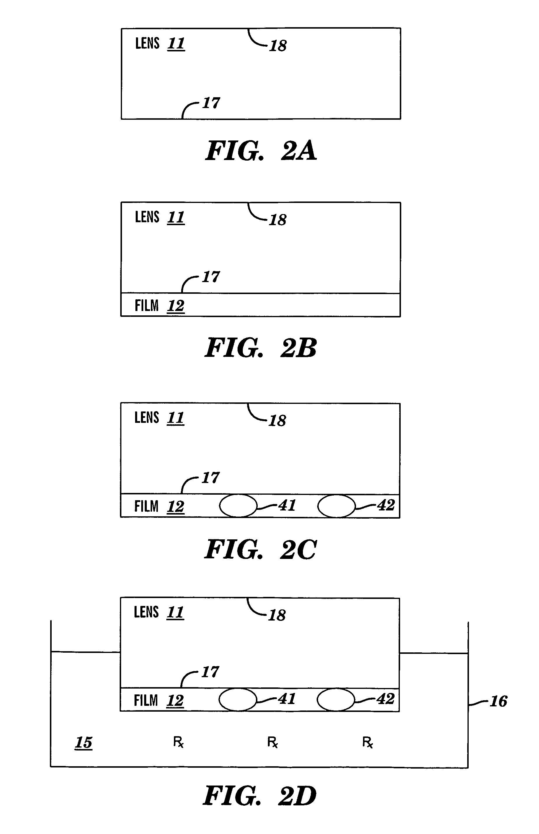 Method and system with contact lens product for treating and preventing adverse eye conditions