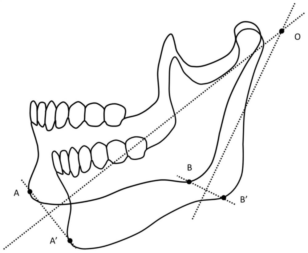 Transverse rotation axis positioning and extracting method for lower jawbone CBCT data