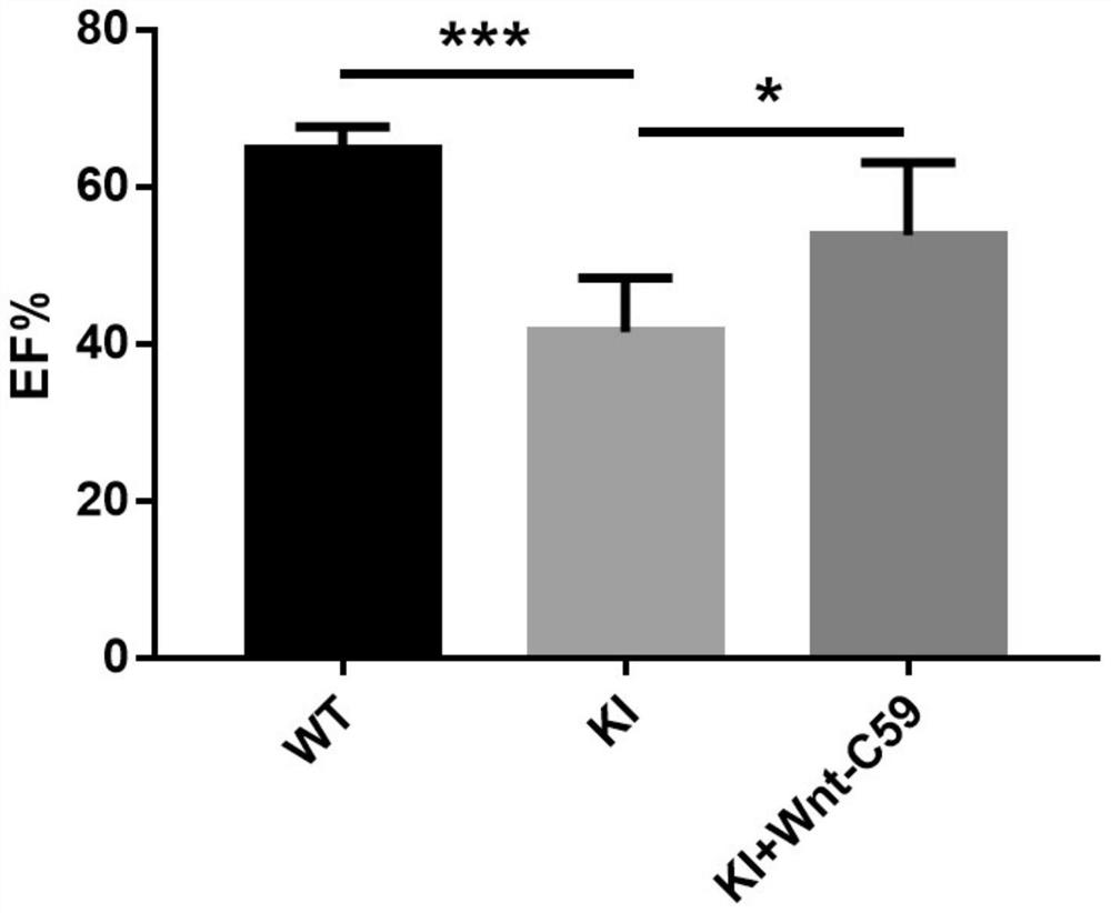 Application of wnt inhibitor wnt-c59 in preparation of medicine for scn5a mutation-induced dilated cardiomyopathy