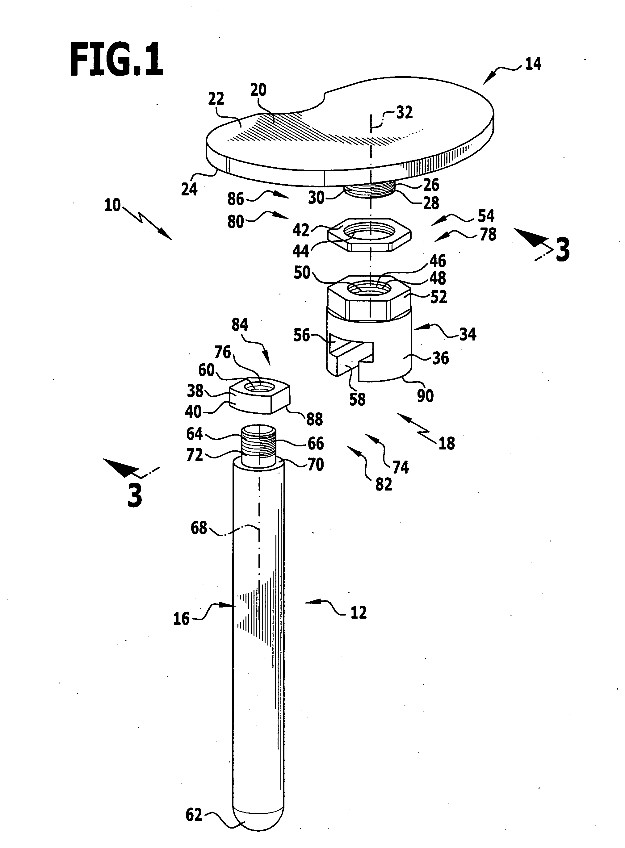 Modular implant part and knee joint prosthesis