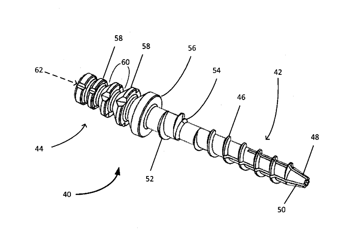 Dental post designed for improved crown bonding and reduced root damage