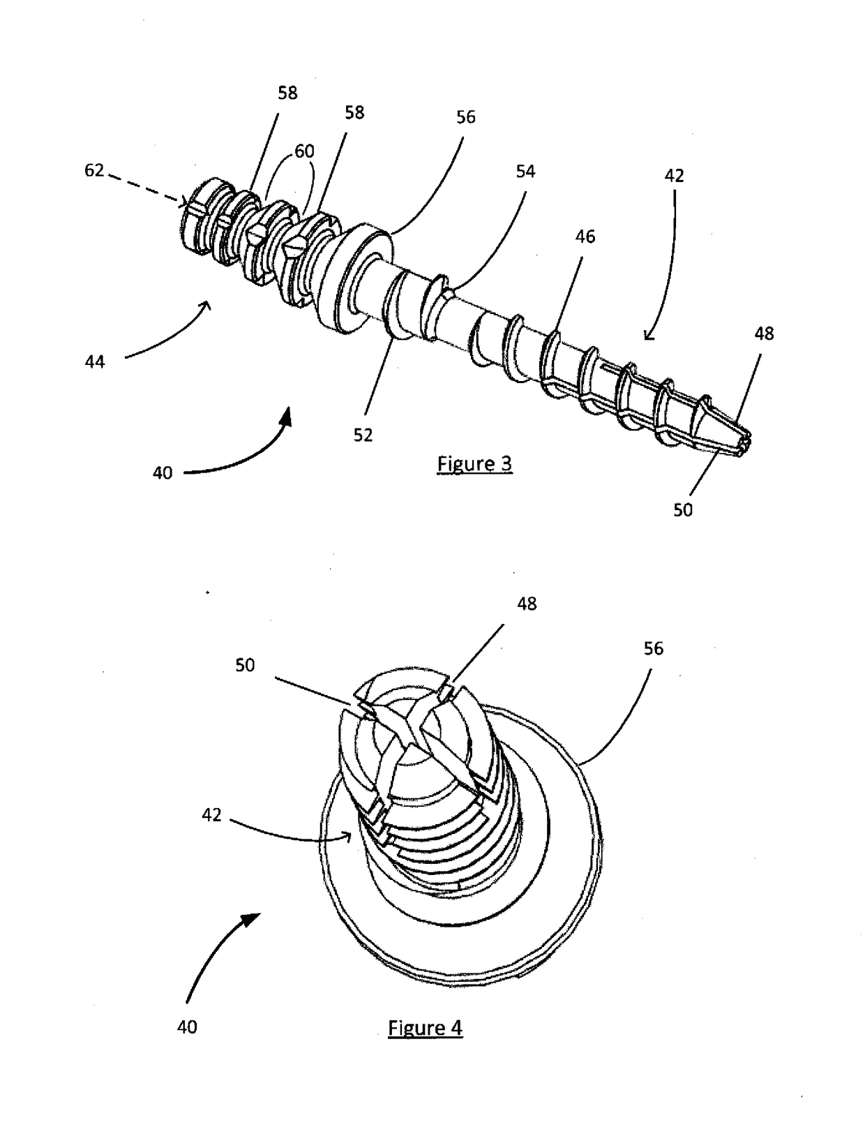 Dental post designed for improved crown bonding and reduced root damage