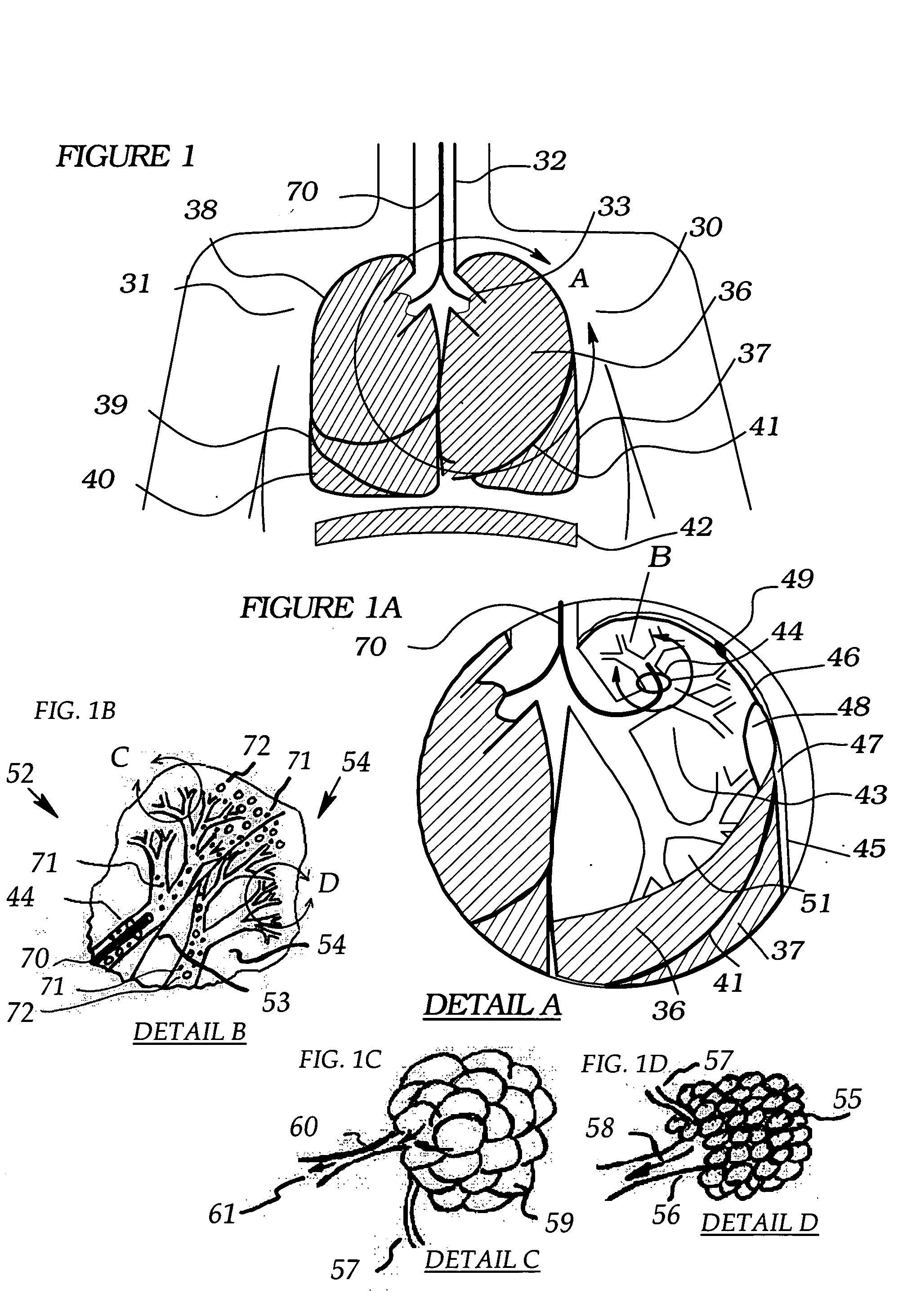 Methods, systems and devices for desufflating a lung area