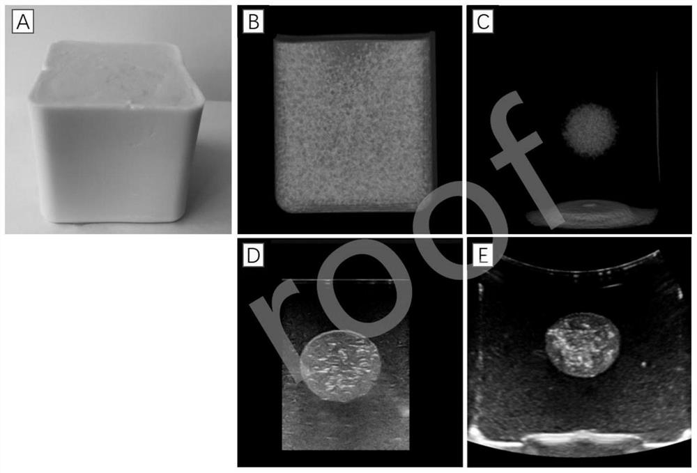 Tumor-bearing tissue model for US/CT-guided downlink tumor puncture or thermal ablation training and preparation method thereof