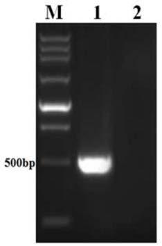 PCR kit for detecting clonorchis sinensis in pigs based on mitochondrial gene nad2 and application