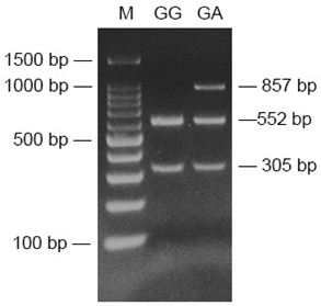 A SNP molecular marker that can be traced back to the source of the double umbilical snail and its application