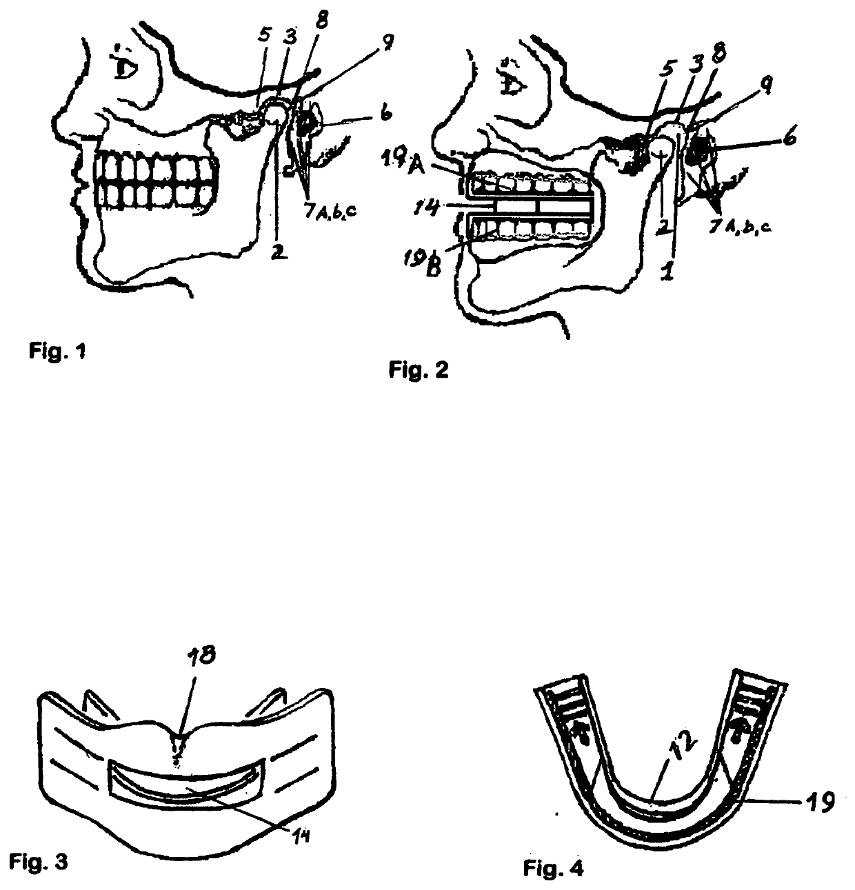 Dual use exercise whitener appliance