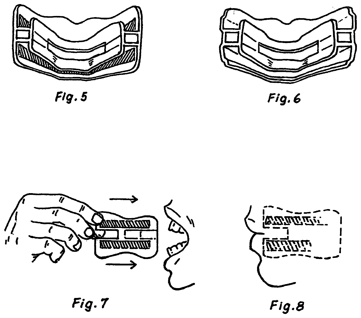 Dual use exercise whitener appliance