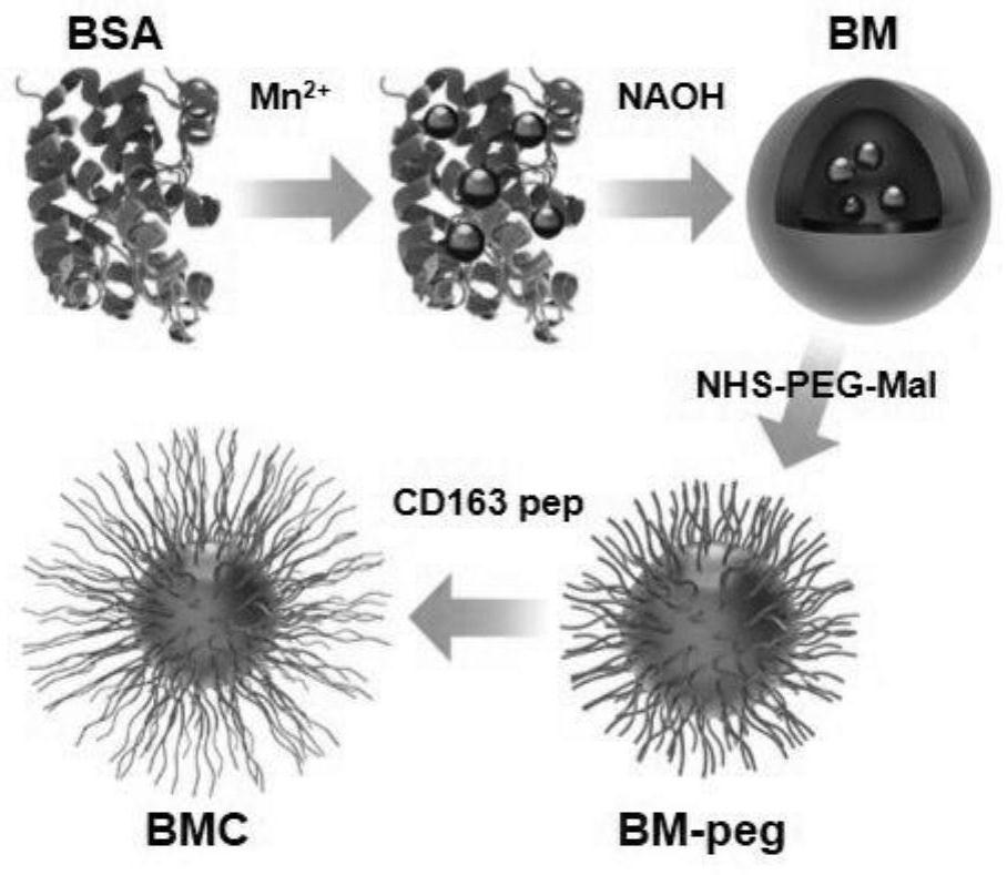 An inflammation-targeting and microenvironment-responsive nanosystem, its preparation method and application