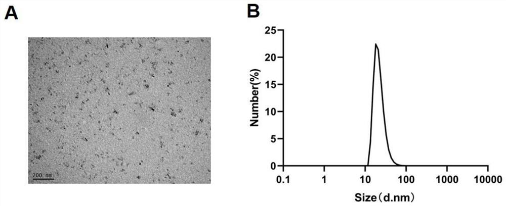 An inflammation-targeting and microenvironment-responsive nanosystem, its preparation method and application