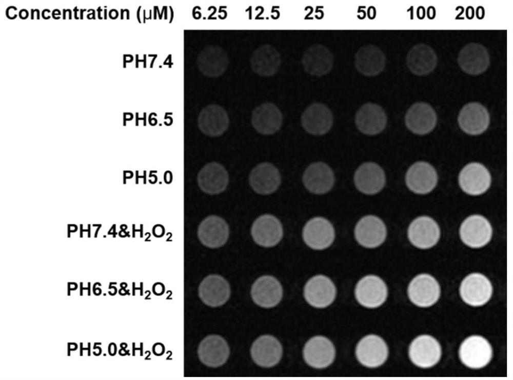 An inflammation-targeting and microenvironment-responsive nanosystem, its preparation method and application