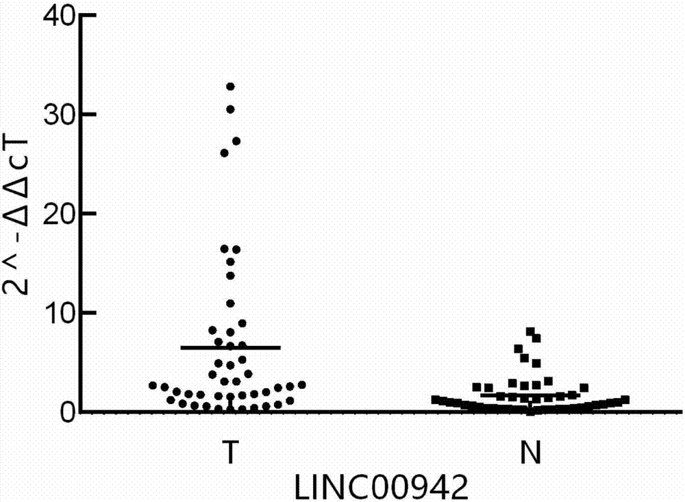 Application of LncRNA to preparation of lung adenocarcinoma diagnosing reagent