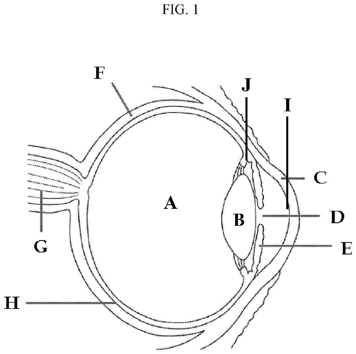 Methods for the treatment of myopia