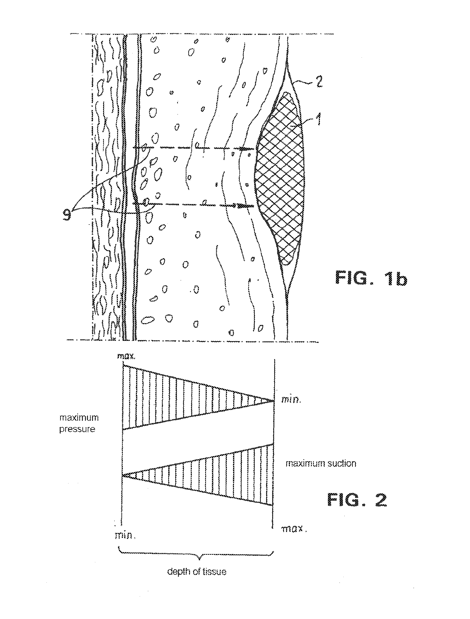 Absorbent article for application to human or animal skin surfaces