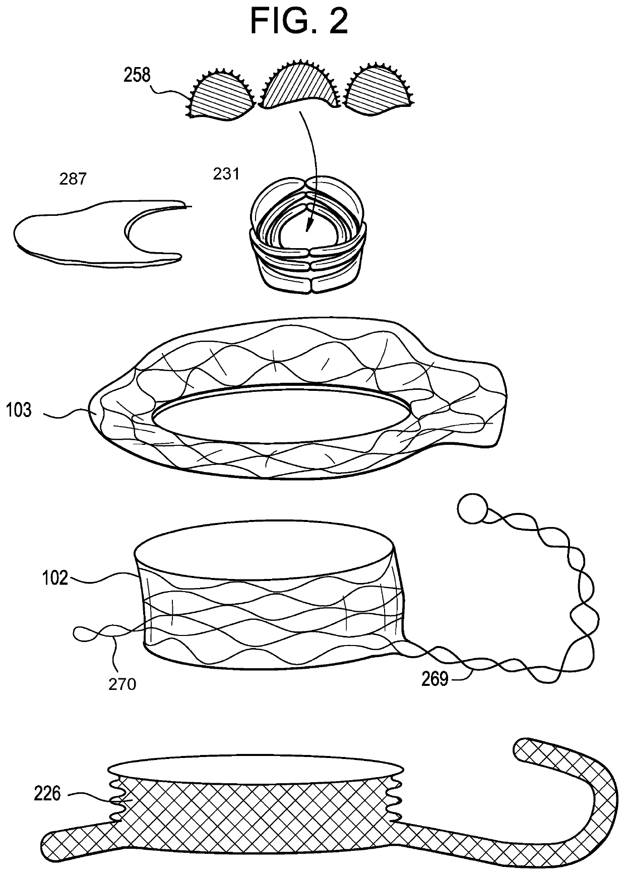 Proximal, distal, and anterior anchoring tabs for side-delivered transcatheter mitral valve prosthesis