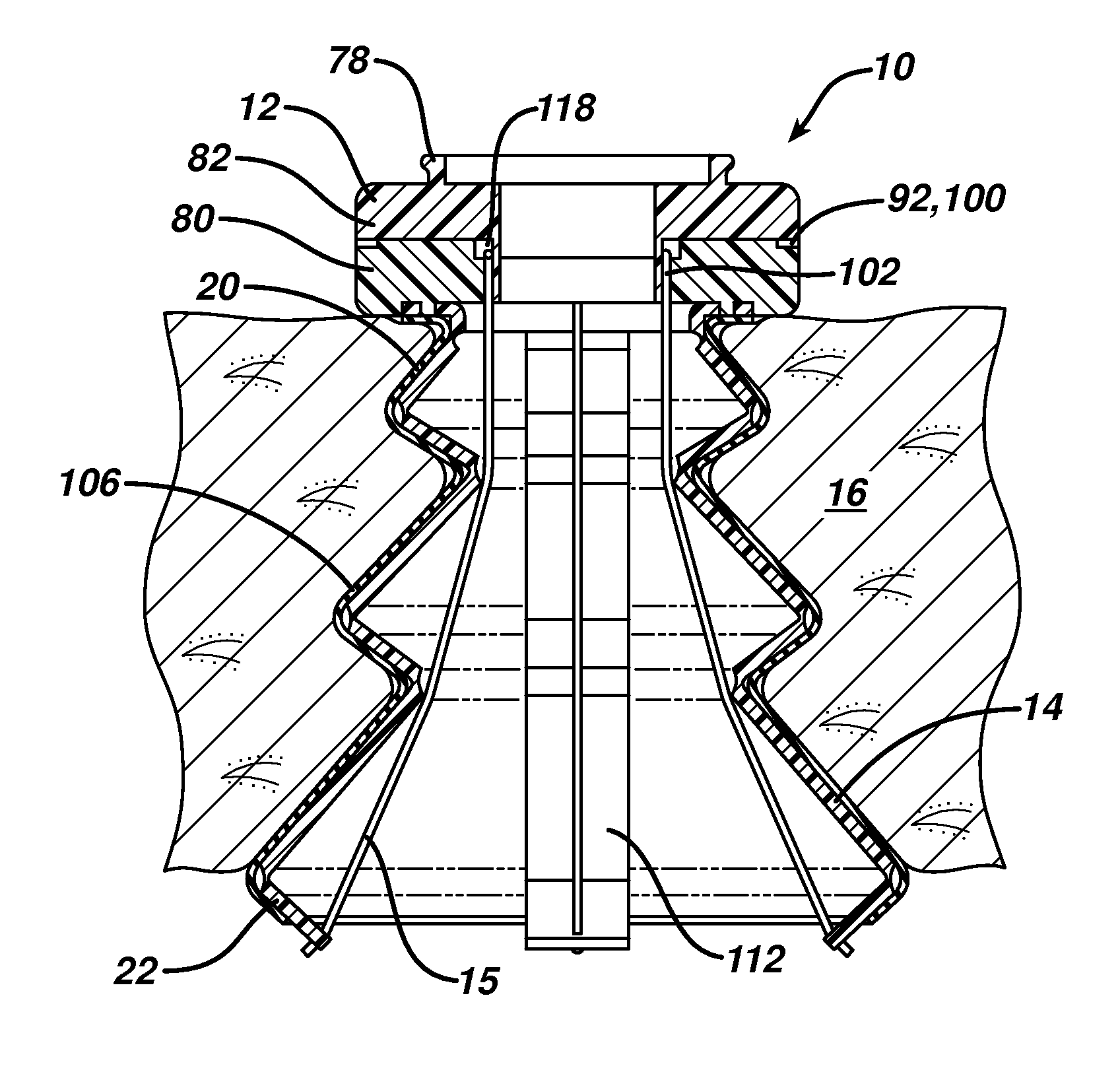 Inverted conical expandable retractor with coil spring